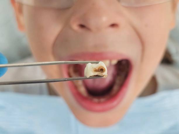 Best Emergency Gum Pain Relief  in Foster Brook, PA